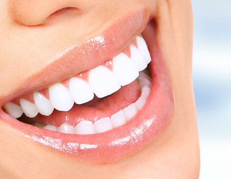 Detecting early decay with Diagnodent