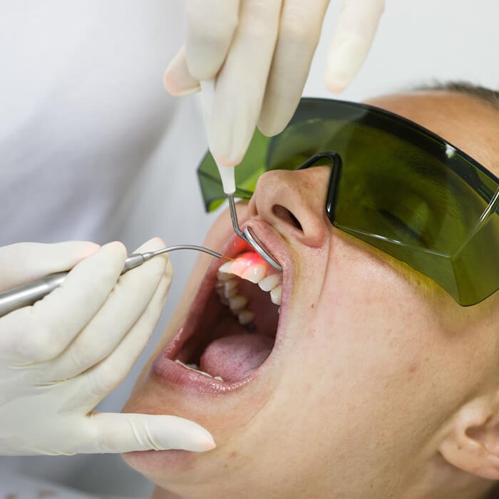 Seeing results from laser dentistry care
