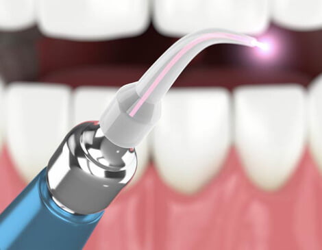 Improving care with laser technology