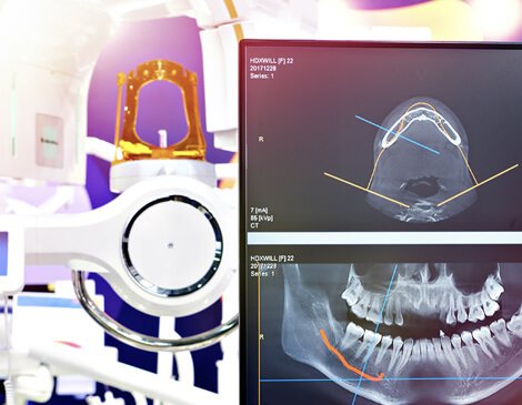Diagnosing with digital radiography