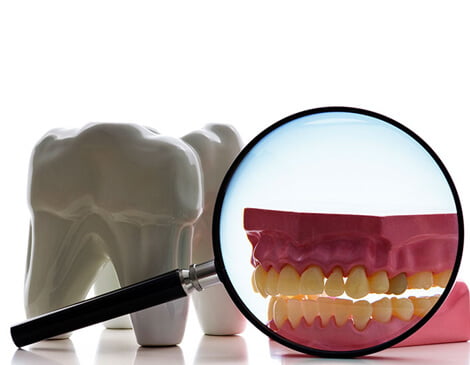 Screening for oral cancer with Trimira