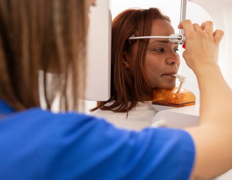 Capturing 3D images with CBCT scans